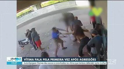 Vítima Agressão PM MA: “Estou Deformada”, Diz Mulher que Tentou Ajudar Outra Agredida por Capitão em Posto