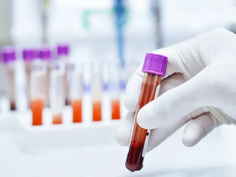 Exame de sangue Galleri, biópsia líquida capaz de detectar sinais de mais de 50 cânceres, chega ao Brasil, custa R$ 6.990 e tem amostras enviadas aos EUA
